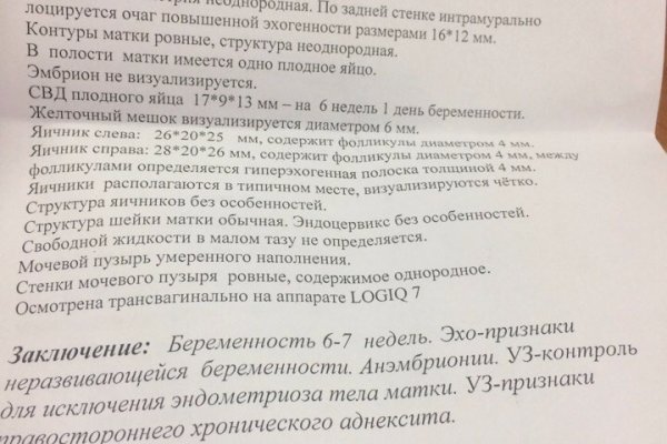 Кракен сайт как выглядит